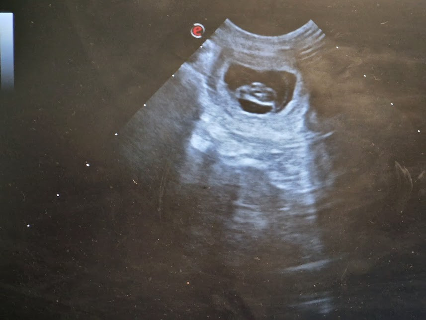 Gestation confirmée